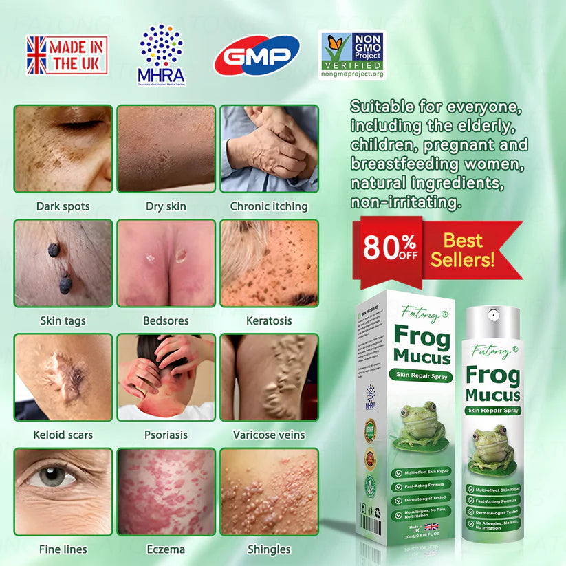 ๐ธ Qooesยฎ Frog Mucus Skin Repair Spray โ Repair, Soothe & Restore Your Skin Instantly