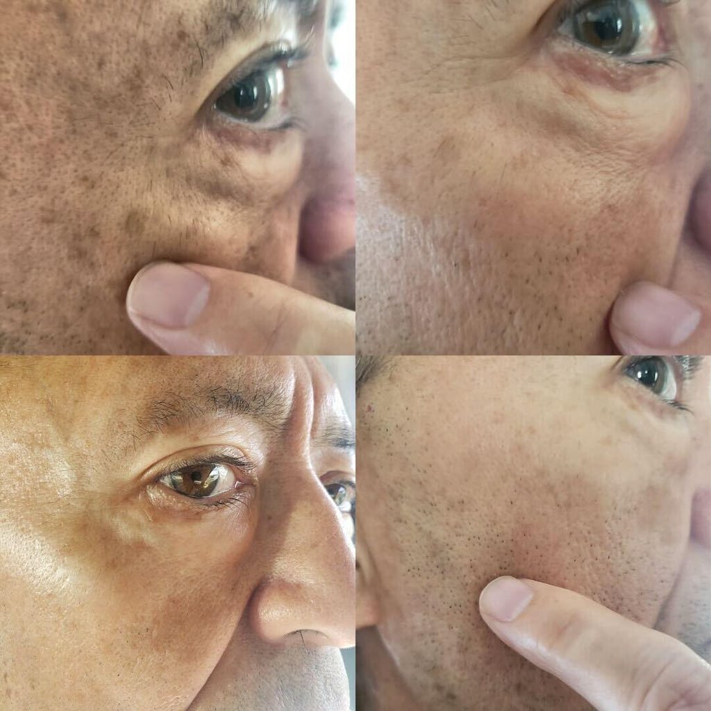 🌟 Glow Up Fast with Qooes® – Dark Spot Corrector & Anti-Aging Renewal Cream🌟