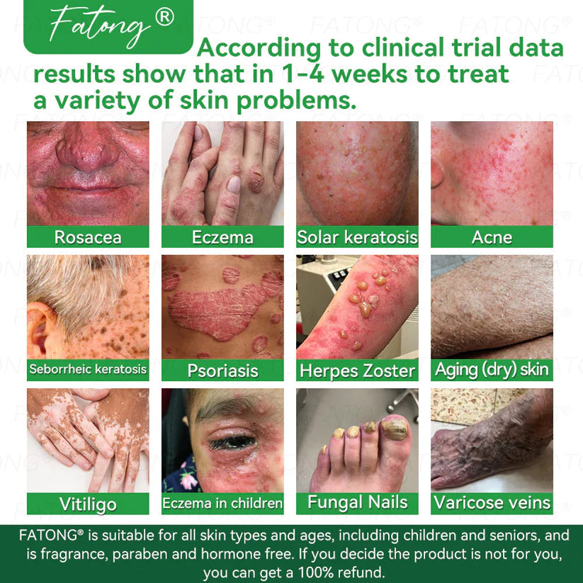 ๐ธ Qooesยฎ Frog Mucus Skin Repair Spray โ Repair, Soothe & Restore Your Skin Instantly