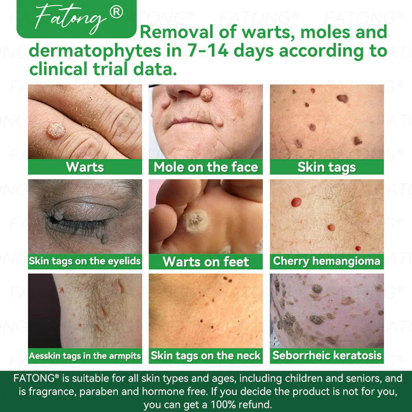 ๐ธ Qooesยฎ Frog Mucus Skin Repair Spray โ Repair, Soothe & Restore Your Skin Instantly