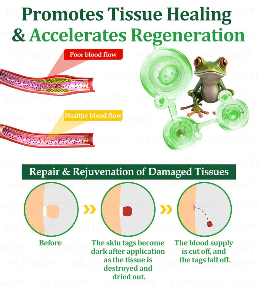 ๐ธ Qooesยฎ Frog Mucus Skin Repair Spray โ Repair, Soothe & Restore Your Skin Instantly