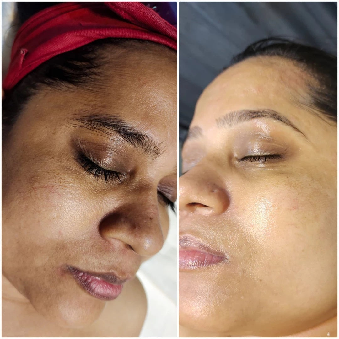 🌟 Glow Up Fast with Qooes® – Dark Spot Corrector & Anti-Aging Renewal Cream🌟