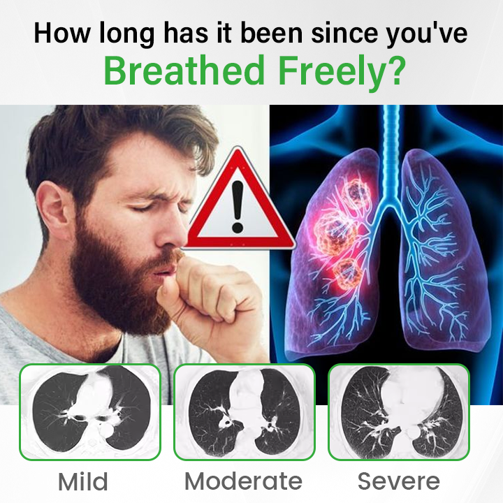 Qooes® Pulmovia Quercetin Lung Detox Inhaler – 98% Absorption, Fast Lung Support