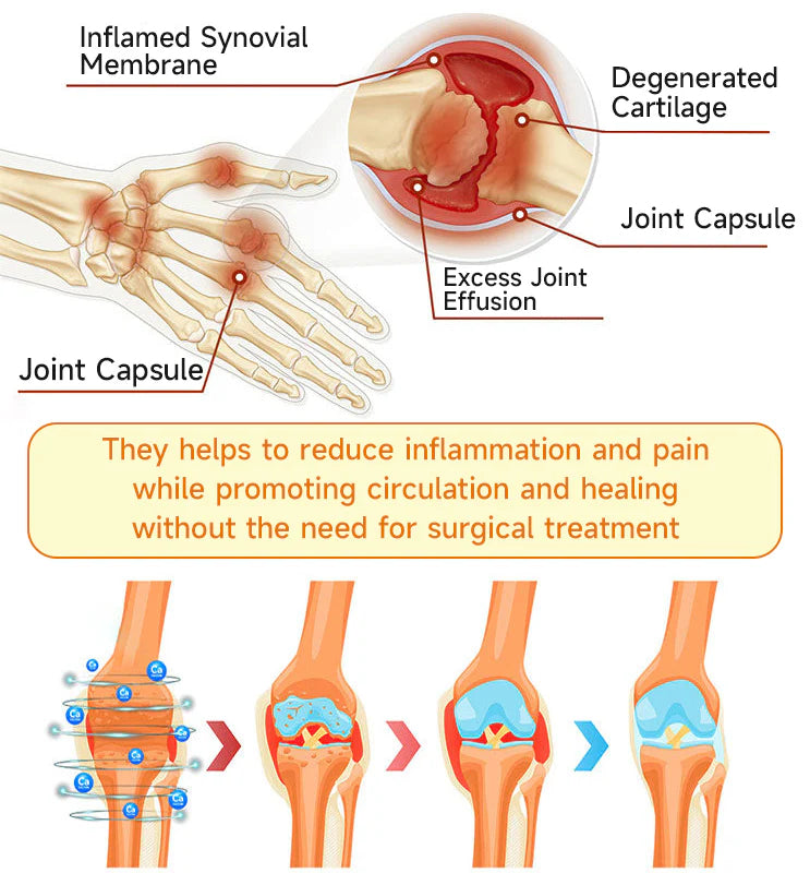 NESLEMY™ Botulinum and Bee Toxin Pain Relief Bone Healing Cream