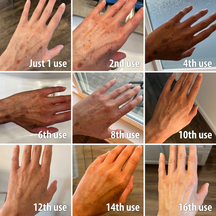 🌟 Glow Up Fast with Qooes® – Dark Spot Corrector & Anti-Aging Renewal Cream🌟